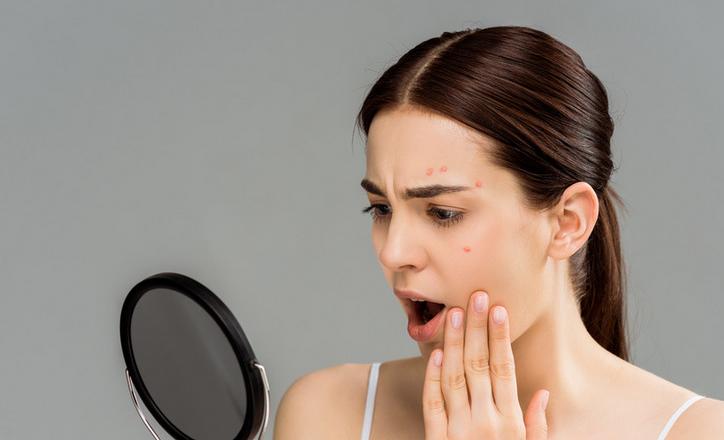 14岁怎么防止脱发,14岁如何避免长残