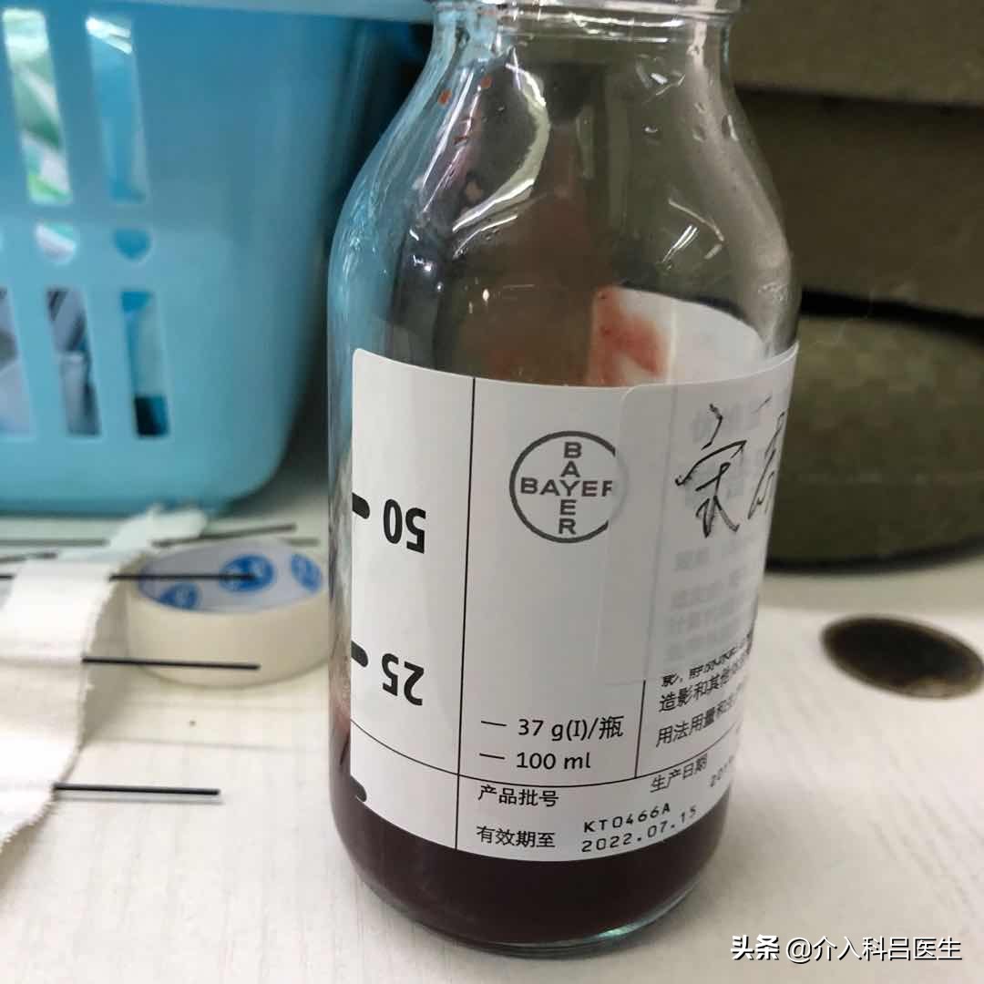 子宫腺肌瘤扎针效果好不好,子宫腺肌症巧囊手术