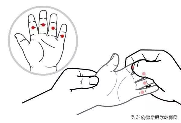 宝宝湿疹怎么推拿处理,小儿推拿治疗湿疹