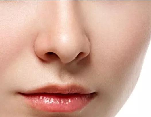 鼻整形增生恢复了鼻子会小吗,鼻整形术后鼻子会肿吗