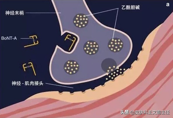 肉毒素不打了会不会老得更快,肉毒素的副作用多久才能消失