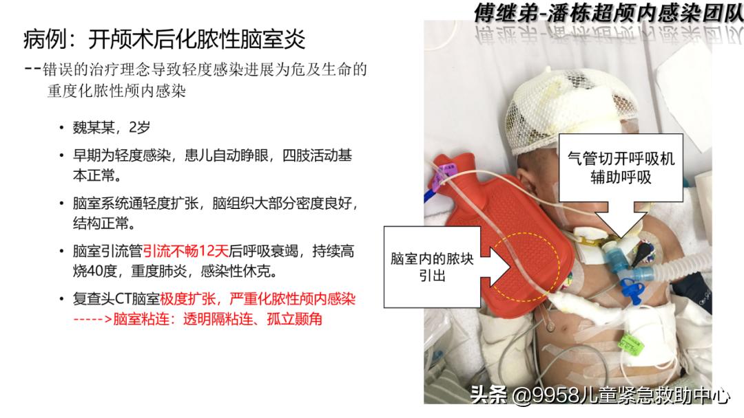 颅内感染康复治疗知识,小儿颅内感染的健康宣教