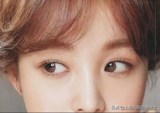 双眼皮修复眼角出现多层疤痕,医生推荐的双眼皮术后祛疤