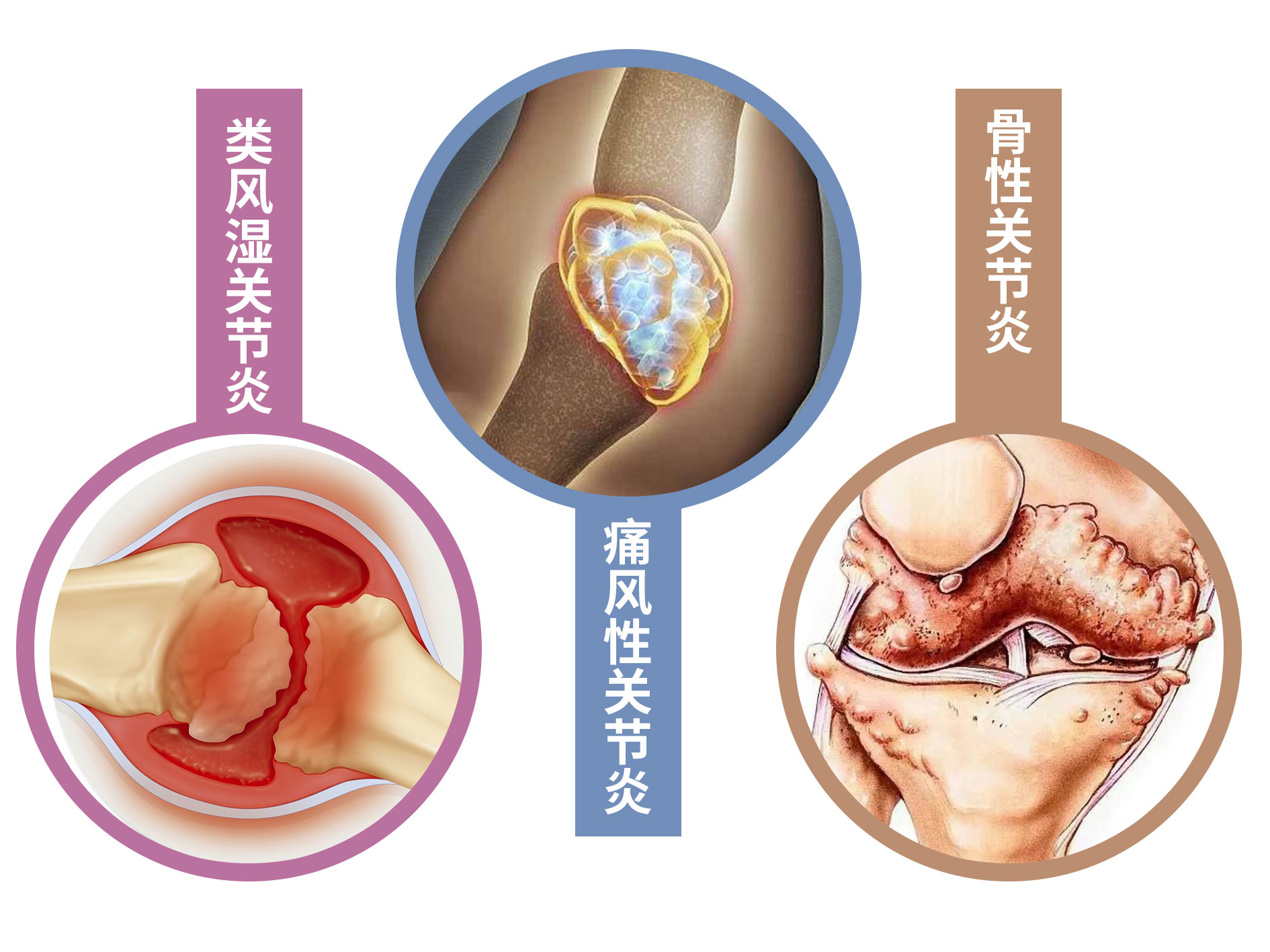 打完封闭后多久可以康复锻炼,打完封闭后24小时后能活动吗