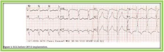全麻拔管后意外气管破裂怎么办？