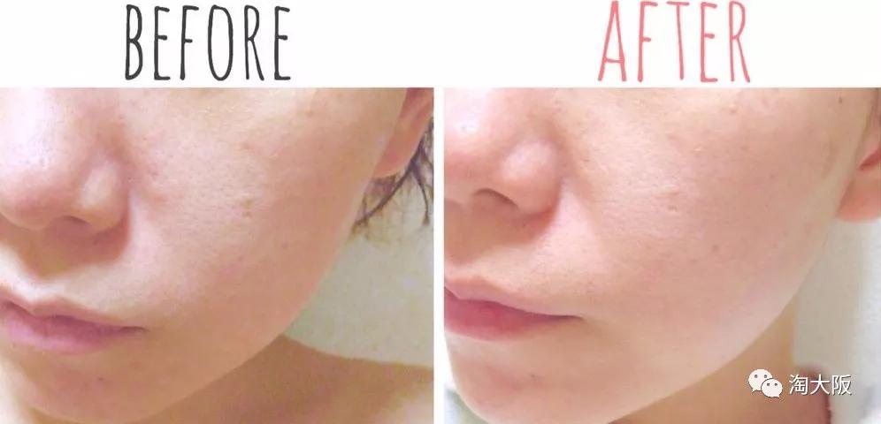 日本的豆腐面膜真的有用吗,盛田屋豆腐面膜的正确使用方法