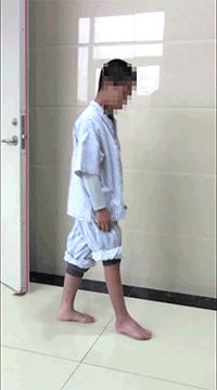 踮脚走路能改善足内翻吗,经常踮脚会伤膝关节吗