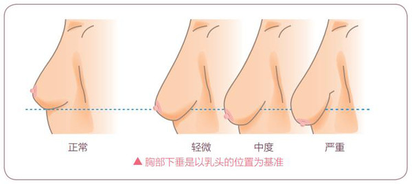 女神杨幂居然有大妈胸？网友：有点明白离婚的原因了