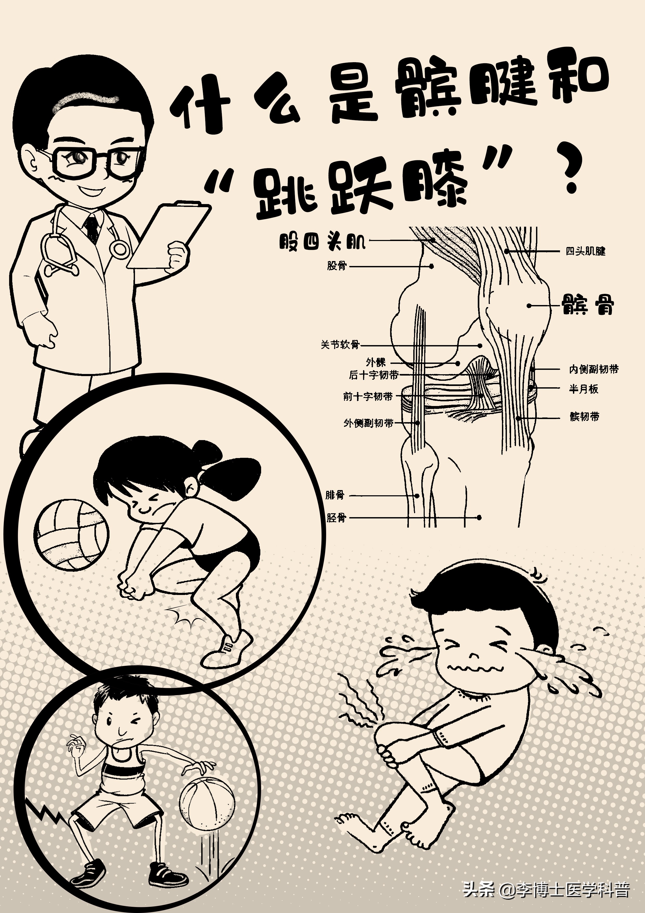 膝关节髌腱炎怎么治疗,膝关节疼痛科普视频参赛作品