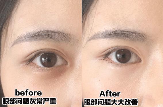 比小棕瓶还好的眼霜,适用于所有黑眼圈的眼霜