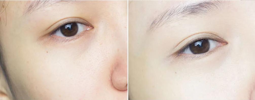 无需美颜轻松拥有水光肌,哪有天生的好底子