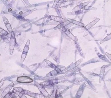 流浪猫猫癣是什么样的,金渐层猫得猫癣什么样