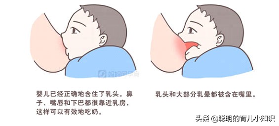 产后开奶后奶硬痛怎么办,产后无痛开奶催乳正确手法