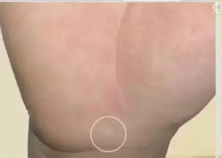 手上7个小细节竟然暗藏大健康,手诊10种常见病从手上就能看出来