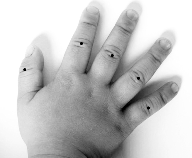 小儿感冒夹惊机制,小孩发烧惊风中医调理