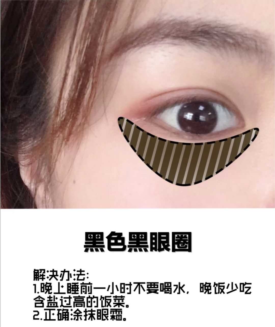 黑眼圈很重怎么办男士,黑眼圈很重怎么办中医教你