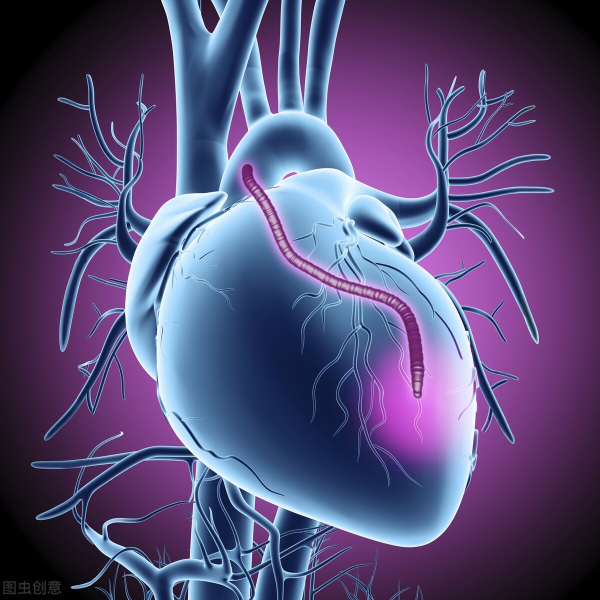 治疗心力衰竭的常用利尿剂,治疗心力衰竭常用的药