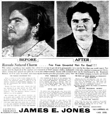 用X光脱毛、试鞋、选美，那些玩X光的勇士最后都怎样了？