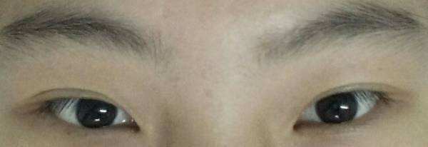 内眼角和外眼角哪个更安全,内眼角和外眼角是什么位置