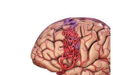 头部开颅手术多久过危险期,啥是开颅手术