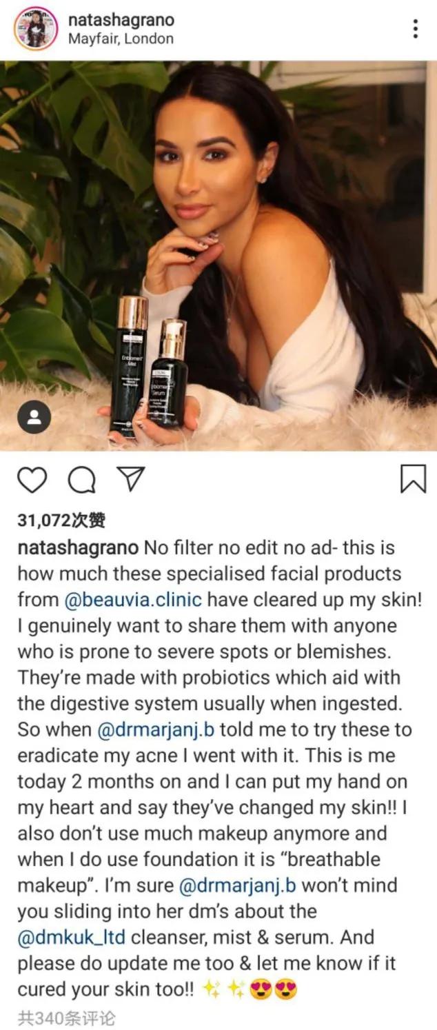 脸上有麻子的国际女明星,有青春痘的女明星