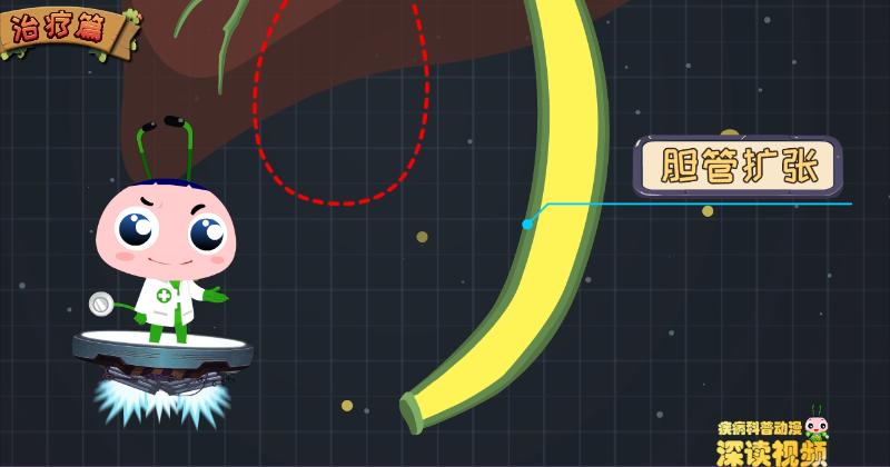 胆囊息肉还是胆囊癌?该如何确诊?动漫解密胆囊息肉检查那些坑