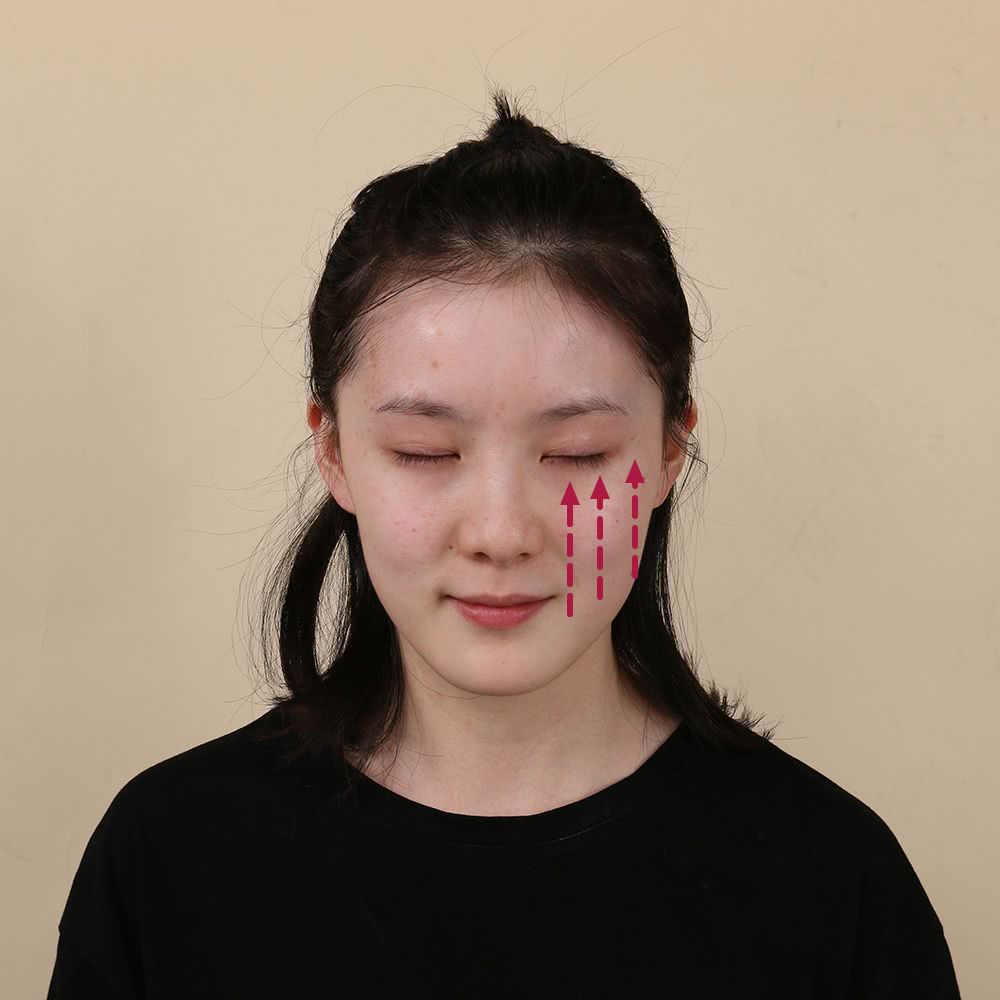 微整的真实效果,微整蜕变过程