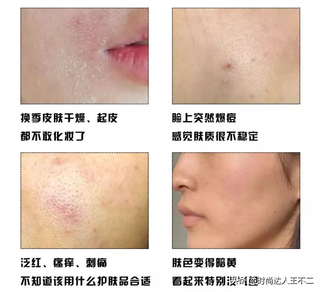 蔡少芬三胎顺利产子产后状态,蔡少芬三胎皮肤