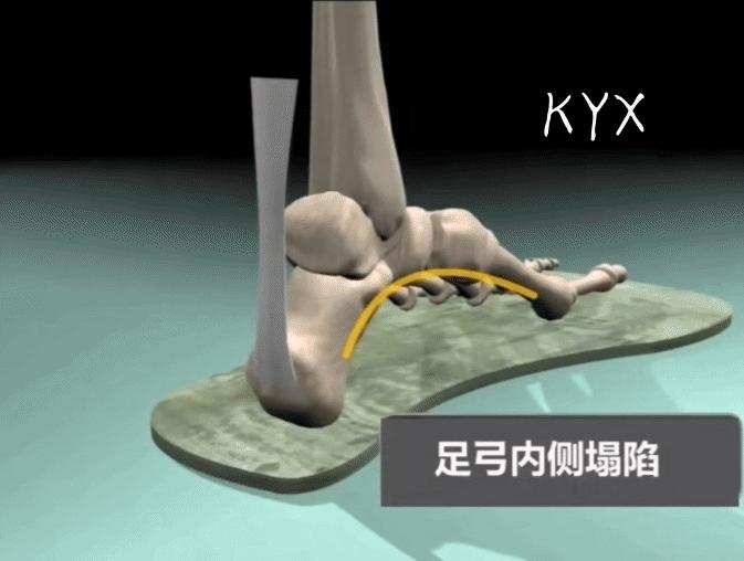 膝关节疼痛位置判断得了什么病,膝关节疼痛一般什么原因引起的