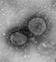 抗击新冠病毒肺炎,新冠病毒感染如何避免造成肺炎