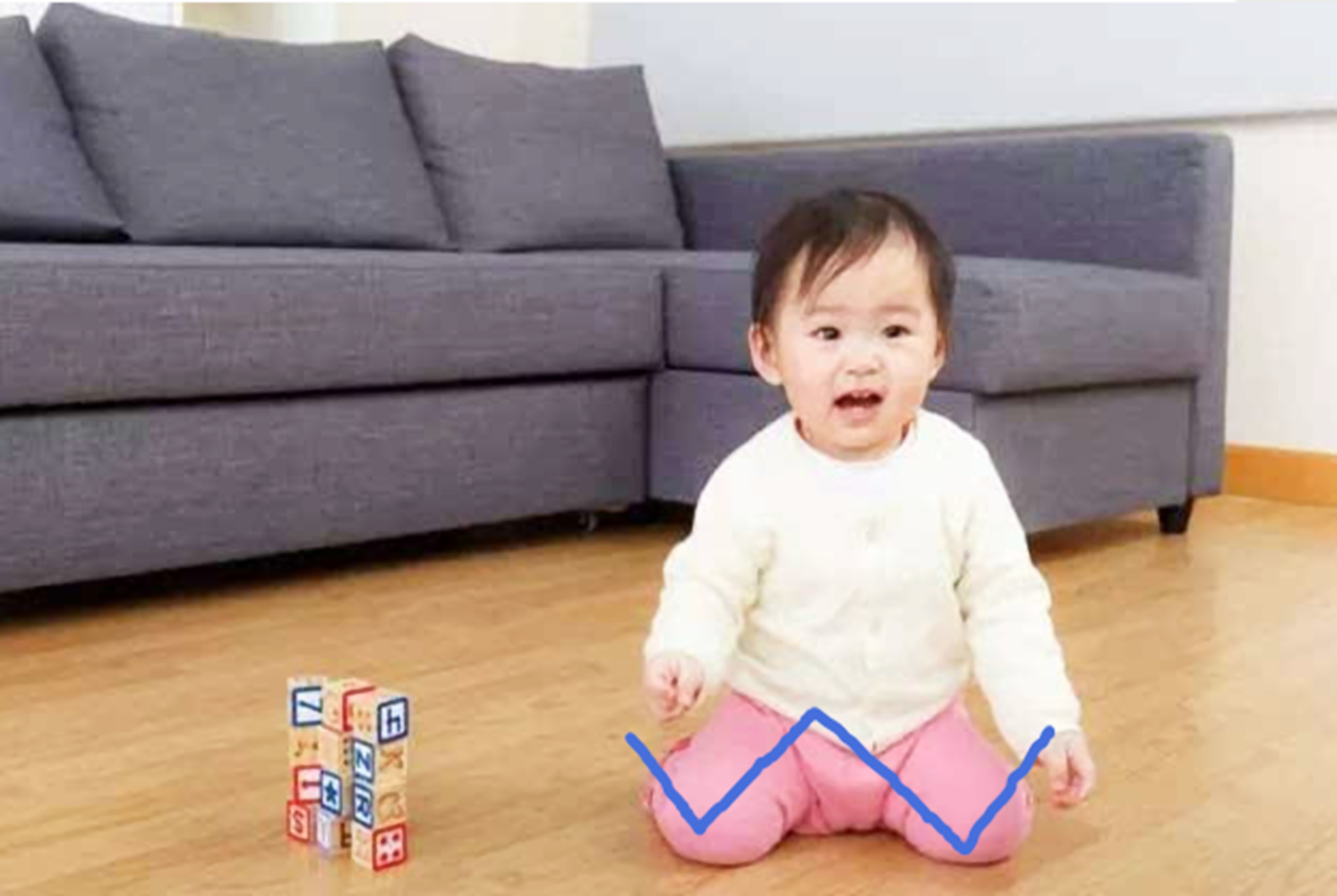 什么原因会导致孩子罗圈腿,孩子有点罗圈腿怎么矫正