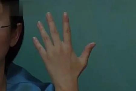 类风湿性关节炎被称为不死的癌症,类风湿为何称不死的癌症