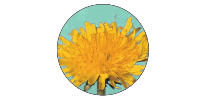 有的人头顶没头发,有的人头发很少但是不脱发