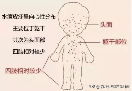 葫芦岛疫情发病症状图示,葫芦岛病情最新公布
