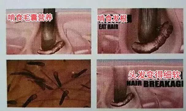 螨虫辟谣大全,你知道螨虫的危害吗涨知识