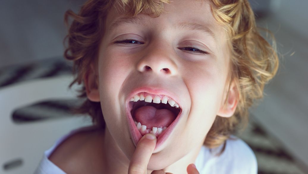 9岁小男孩前门牙长歪还换牙吗,7岁儿童换牙新牙长歪了怎么办