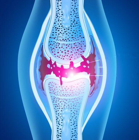 如何预防老年个子变矮,人到中年身高会变矮是怎么回事