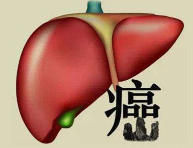 癌症会传染吗?医生说:一般是不会,但是这3种要区别对待