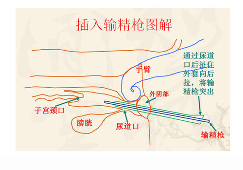 奶牛繁育与人工授精百科,奶牛人工授精动画流程