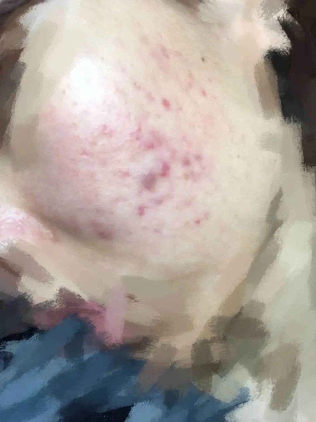 用大牌化妆品真的不会老吗,用大牌护肤品皮肤还是不好