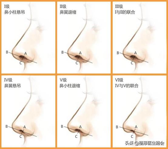 听说好看的鼻子都有一只海鸥在飞，你的海鸥飞得怎么样？