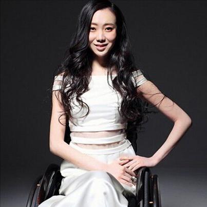 张艺谋谈奥运瘫痪女孩,张艺谋2008奥运谁残疾