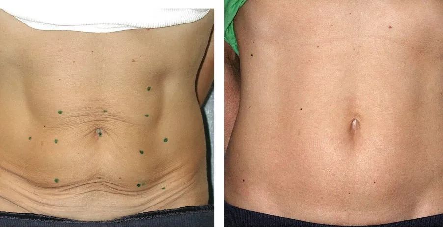 39岁高圆圆产后首次晒照,40岁高圆圆产后首次亮相