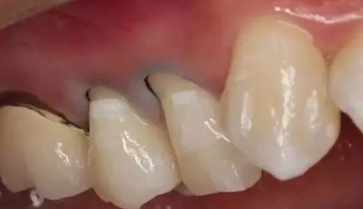 刷牙前该不该漱口水,刷牙前为什么牙膏不要沾水