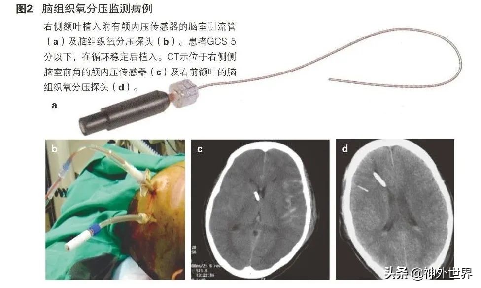 日本脑神经功能检测仪,日本血氧监测