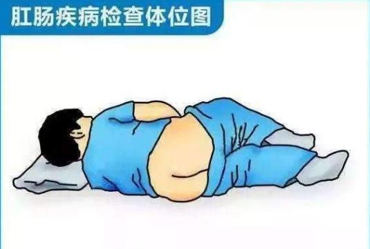 为什么有些人不愿意肛检,肛门指诊怎么治疗