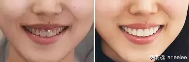 最好用的牙膏排行榜前十名,选哪个牌子的牙膏最安全好用