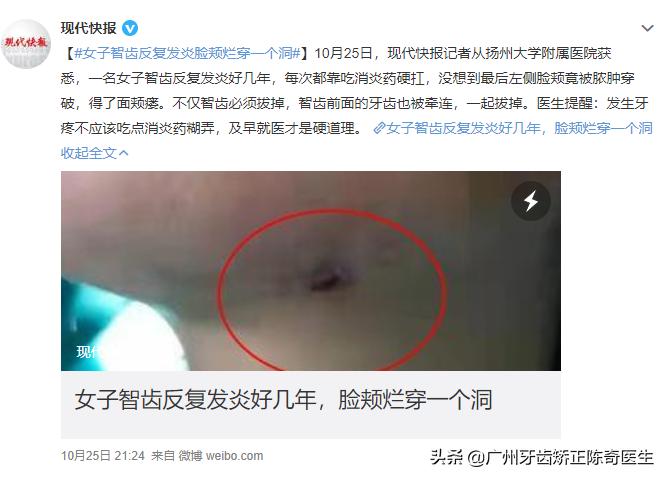 智齿发炎有脓是否需要切开,智齿反复发炎不去拔掉的后果