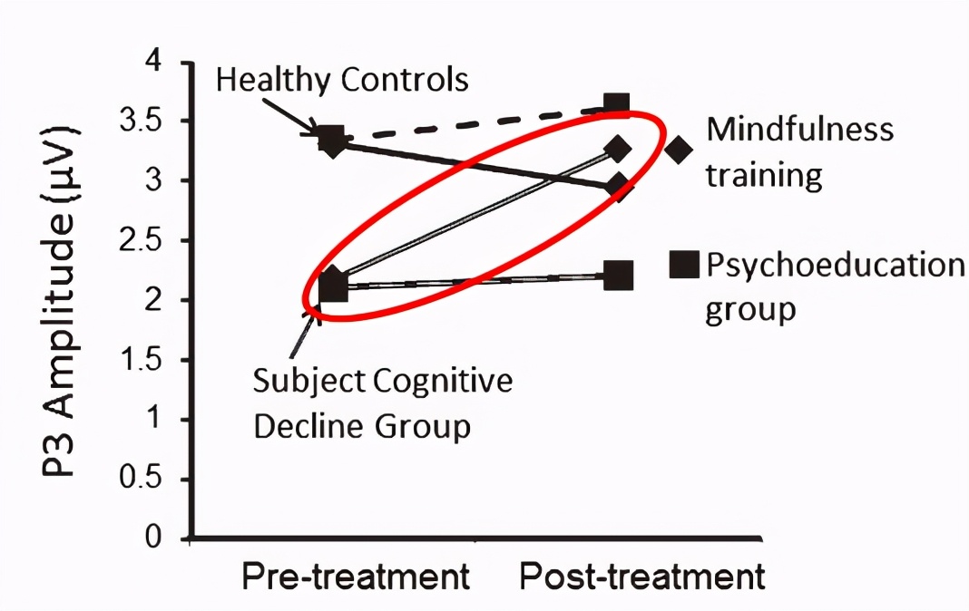 有这些方法可以延缓失智症的发生与发展