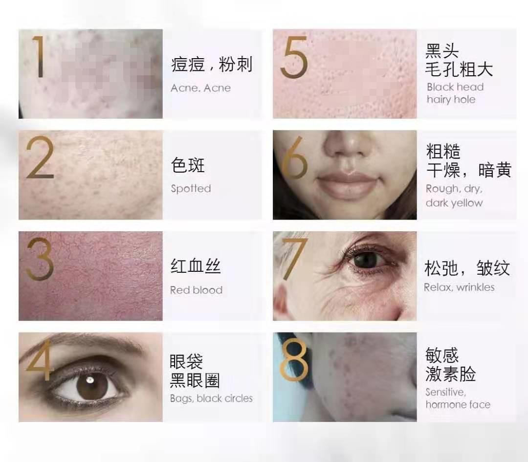 普及胶原蛋白对面部的优势,youngdoctor胶原蛋白肽是智商税吗